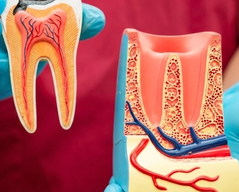 emergency root canal edmonton