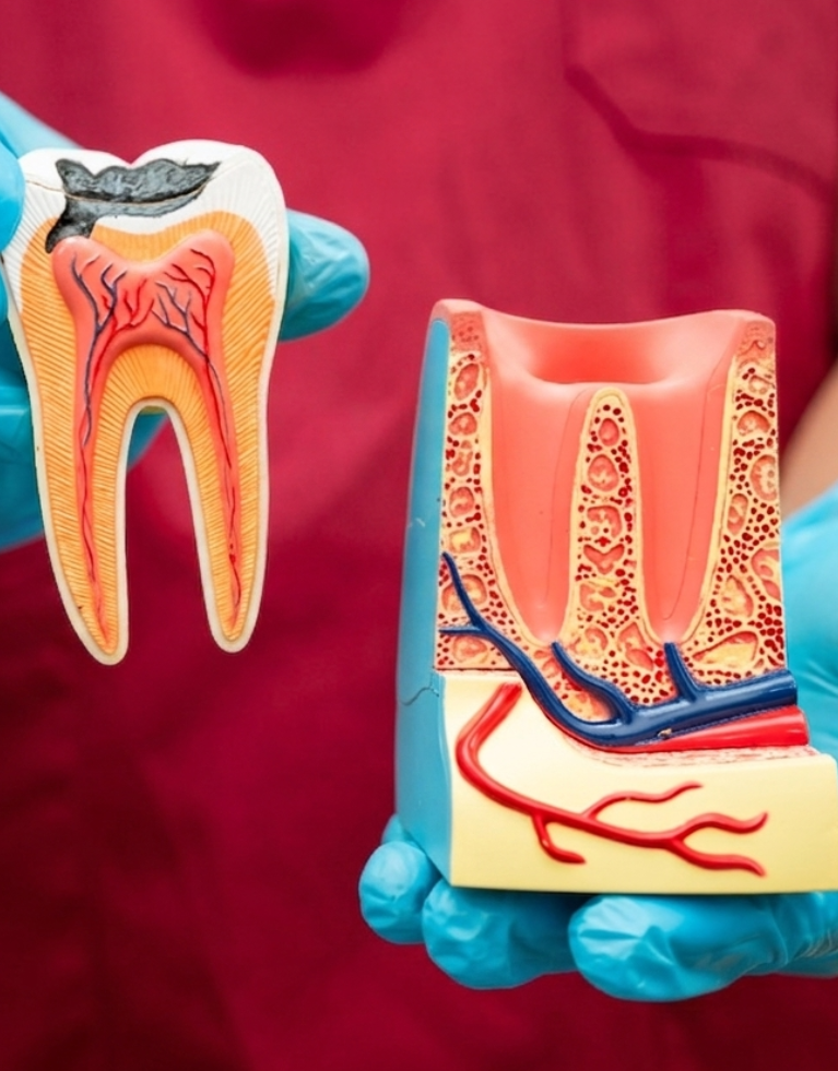 emergency root canal edmonton