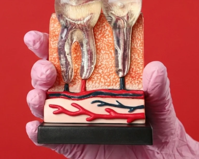 Emergency Tooth Extraction Edmonton